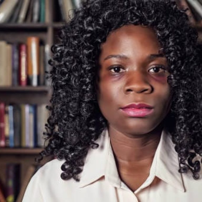 Portrait of an African American woman with bruises. Domestic violence concept.